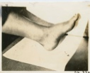 Image of Arch of a foot